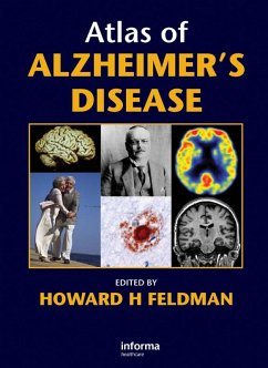 Atlas of Alzheimer's Disease (eBook, ePUB) - Feldman, Howard