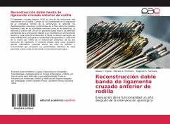 Reconstrucción doble banda de ligamento cruzado anterior de rodilla