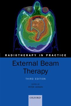 Cover External Beam Therapy (eBook, ePUB)