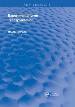 Cover Experimental Liver Transplantation (eBook, PDF)