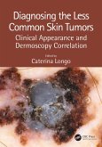 Diagnosing the Less Common Skin Tumors (eBook, PDF)