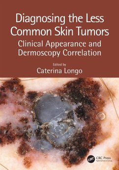 Diagnosing the Less Common Skin Tumors (eBook, ePUB)