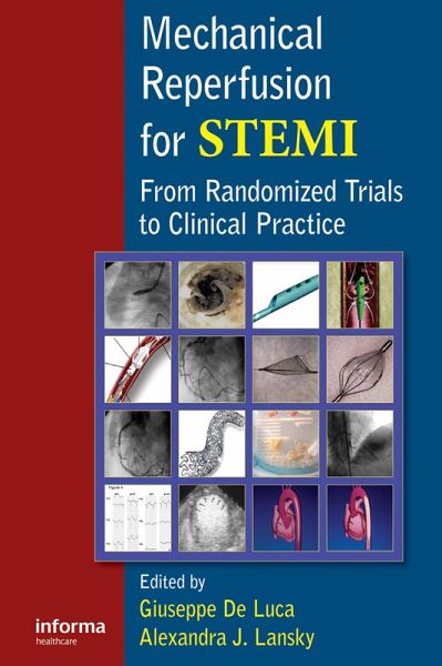 Mechanical Reperfusion for STEMI (eBook, PDF) Mechanical Reperfusion for STEMI (eBook, PDF)