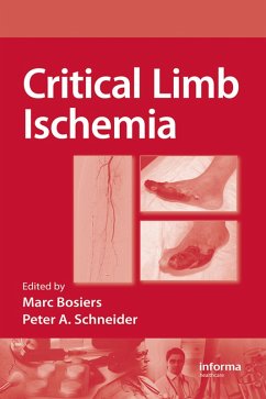 Cover Critical Limb Ischemia (eBook, PDF)