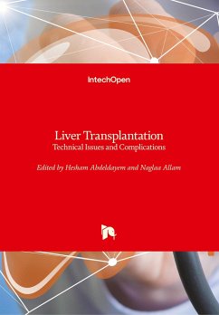 Liver Transplantation