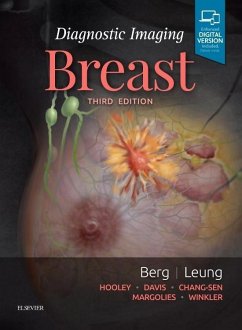 Diagnostic Imaging: Breast - Berg, Wendie A; Leung, Jessica