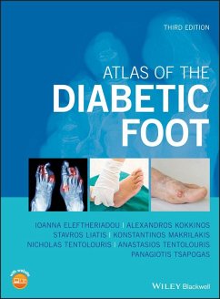 Atlas of the Diabetic Foot (eBook, ePUB) - Eleftheriadou, Ioanna; Kokkinos, Alexandros; Liatis, Stavros; Makrilakis, Konstantinos; Tentolouris, Nicholas; Tentolouris, Anastasios; Tsapogas, Panagiotis