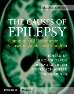 Cover Causes of Epilepsy (eBook, PDF)