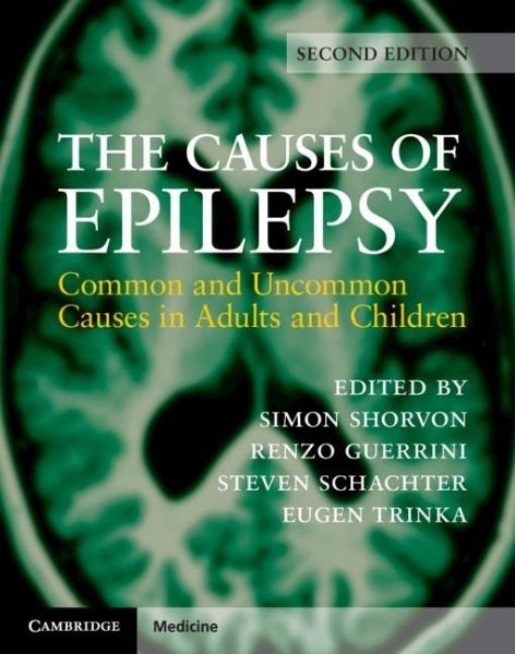 Causes of Epilepsy (eBook, PDF) Causes of Epilepsy (eBook, PDF)