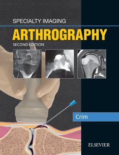 Specialty Imaging: Arthrography (eBook, ePUB) - Crim, Julia R.