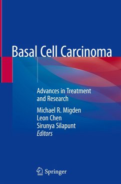 Basal Cell Carcinoma