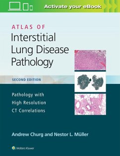 Atlas of Interstitial Lung Disease Pathology - Churg, Andrew; Muller, Nestor L.
