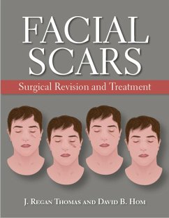 Facial Scars (eBook, ePUB)