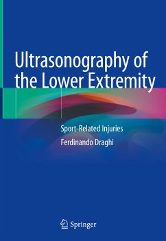 Ultrasonography of the Lower Extremity (eBook, PDF) - Draghi, Ferdinando