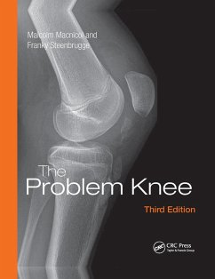The Problem Knee - Macnicol, Malcolm; Steenbrugge, Franky