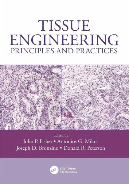 Tissue Engineering Tissue Engineering