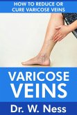 Varicose Veins: How To Reduce Or Cure Varicose Veins (eBook, ePUB) Varicose Veins: How To Reduce Or Cure Varicose Veins (eBook, ePUB)