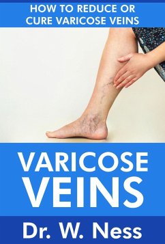 Varicose Veins: How To Reduce Or Cure Varicose Veins (eBook, ePUB) - Ness, W.
