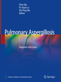 Pulmonary Aspergillosis (eBook, PDF)