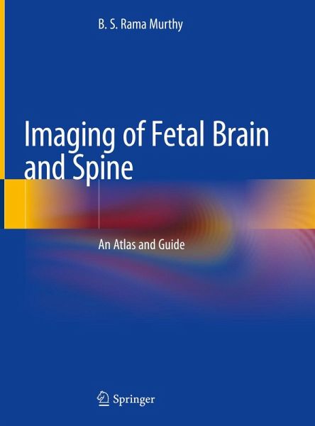 Imaging of Fetal Brain and Spine (eBook, PDF) Imaging of Fetal Brain and Spine (eBook, PDF)