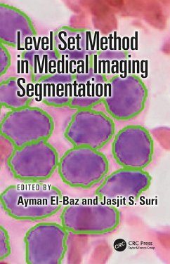 Level Set Method in Medical Imaging Segmentation (eBook, ePUB)