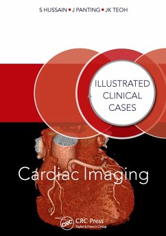 Cardiac Imaging (eBook, PDF) - Hussain, Shahid; Panting, Jonathan; Kiat Teoh, Jun
