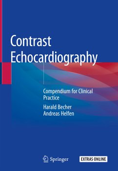 Contrast Echocardiography (eBook, PDF) - Becher, Harald; Helfen, Andreas