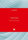 Tachycardia