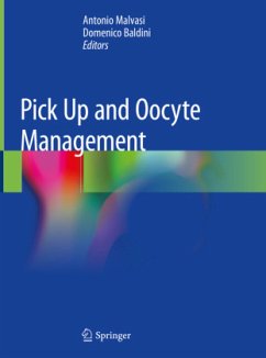 Pick Up and Oocyte Management