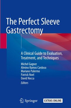 The Perfect Sleeve Gastrectomy