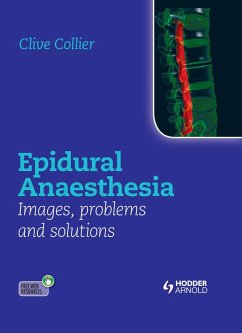 Cover Epidural Anaesthesia: Images, Problems and Solutions (eBook, PDF)