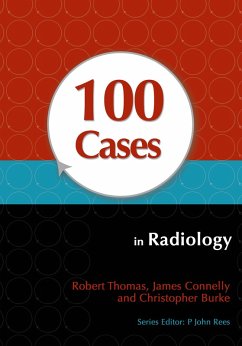 100 Cases in Radiology (eBook, PDF) - Thomas, Robert; Connelly, James; Burke, Christopher
