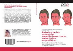 Relación de las asimetrías mandibulares con la maloclusión esquelética - España Pamplona, Pilar;Tarazona Alvar, Beatriz;Zamora Martine, Natalia