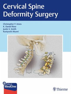Cover Cervical Spine Deformity Surgery (eBook, PDF)