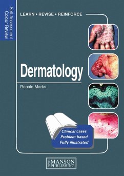Dermatology (eBook, PDF) - Marks, Ronald