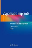 Zygomatic Implants