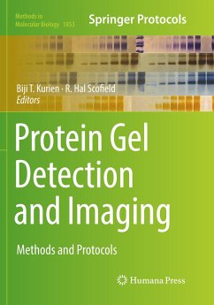 Protein Gel Detection and Imaging