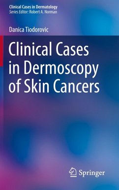 Clinical Cases in Dermoscopy of Skin Cancers - Tiodorovic, Danica