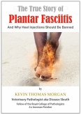 The True Story of Plantar Fasciitis: And Why Heel Injections Should Be Banned (eBook, ePUB)