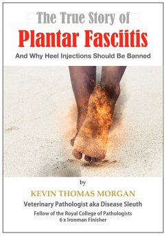 The True Story of Plantar Fasciitis: And Why Heel Injections Should Be Banned (eBook, ePUB) - Morgan, Kevin Thomas