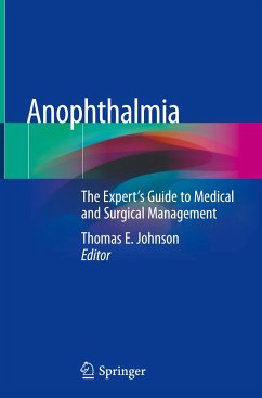 Anophthalmia