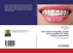 Safe zones in maxilla, palate and mandible for mini-implant placement