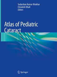 Atlas of Pediatric Cataract (eBook, PDF)