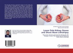 Lower Pole Kidney Stones and Shock Wave Lithotripsy