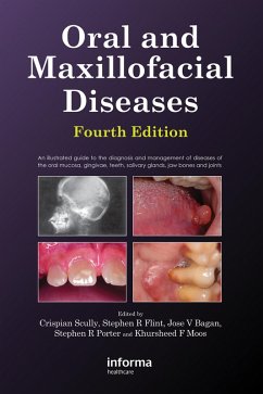 Oral and Maxillofacial Diseases (eBook, PDF) Cover Oral and Maxillofacial Diseases (eBook, PDF)