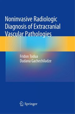 Noninvasive Radiologic Diagnosis of Extracranial Vascular Pathologies - Todua, Fridon;Gachechiladze, Dudana