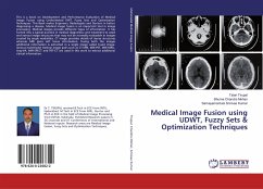 Medical Image Fusion using UDWT, Fuzzy Sets & Optimization Techniques