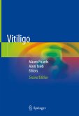 Vitiligo (eBook, PDF)