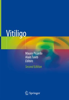 Vitiligo (eBook, PDF)