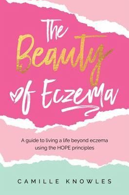 The Beauty of Eczema (eBook, ePUB)